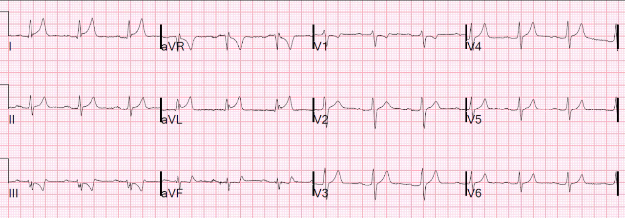 Royals lead the nation in sending good luck messages to the Lionesses ... Royals lead the nation in sending good luck messages to the Lionesses ...